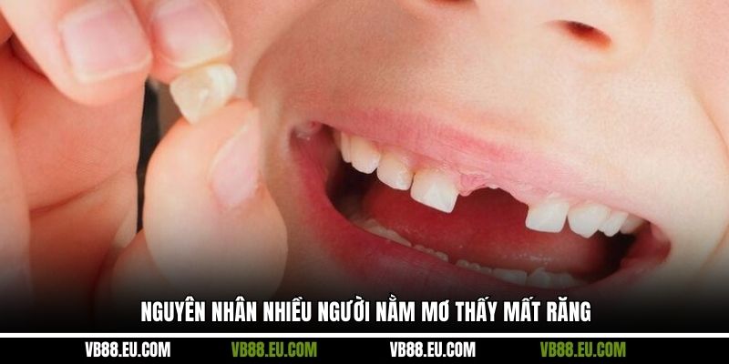 Nguyên nhân nhiều người nằm mơ thấy mất răng